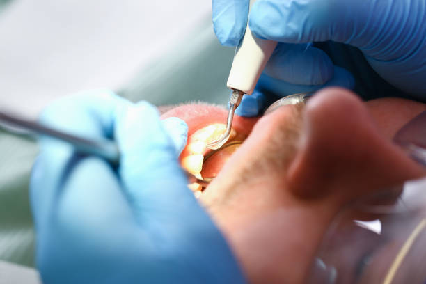 Best Emergency Denture Repair in Fiskdale, MA