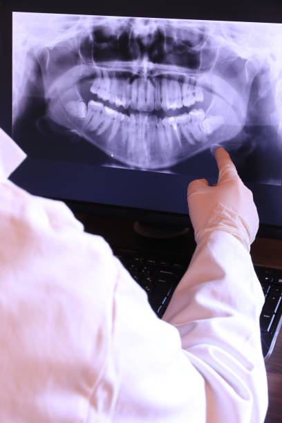 Best Broken or Chipped Tooth Repair in Fiskdale, MA