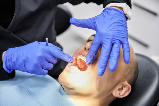 Best Broken or Chipped Tooth Repair in Fiskdale, MA