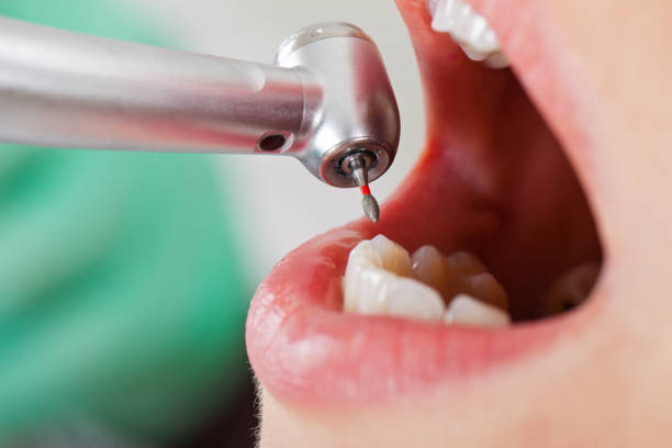 Best Emergency Treatment for Jaw Pain or Injury in Fiskdale, MA